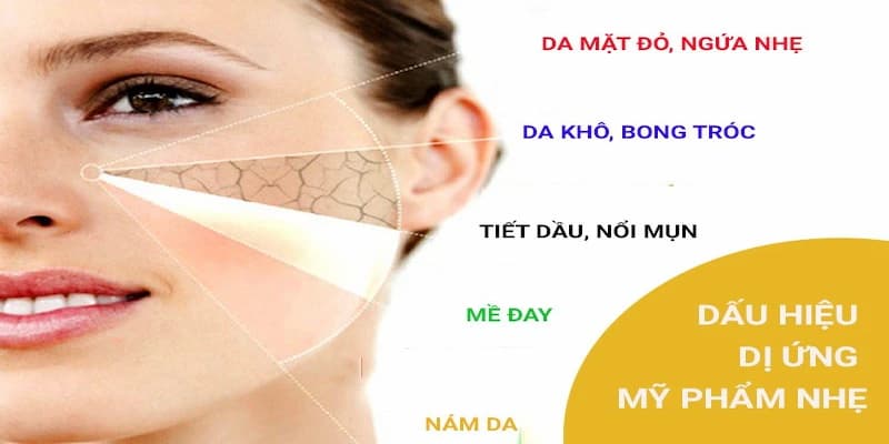 dị ứng mỹ phẩm