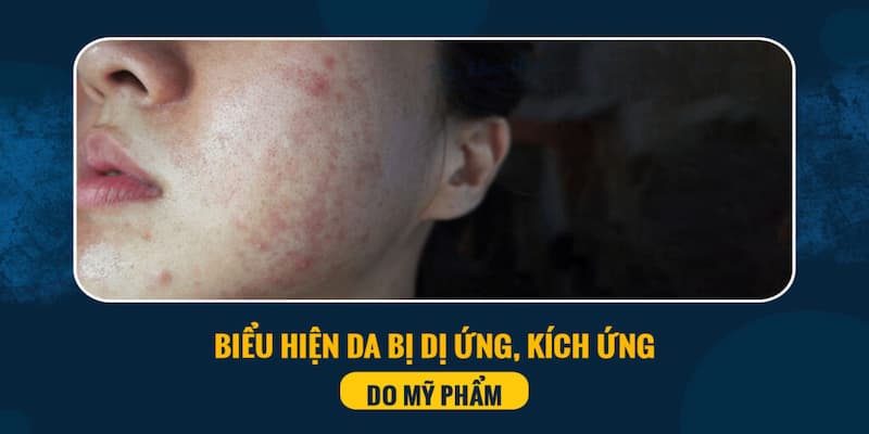 Biểu hiện dị ứng xảy ra do thành phẩm trong sản phẩm không hợp với da 