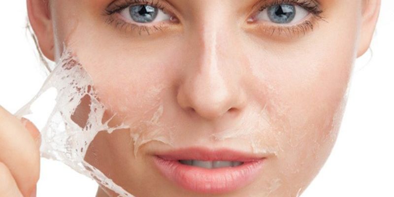 Những phương pháp giúp chăm sóc da sau peel hiệu quả