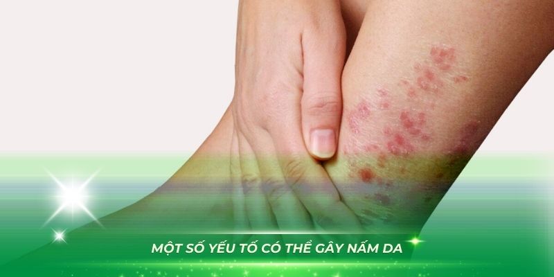 Một số yếu tố có thể gây nấm da