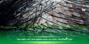 Tìm hiểu về căn bệnh nấm da đầu thường gặp